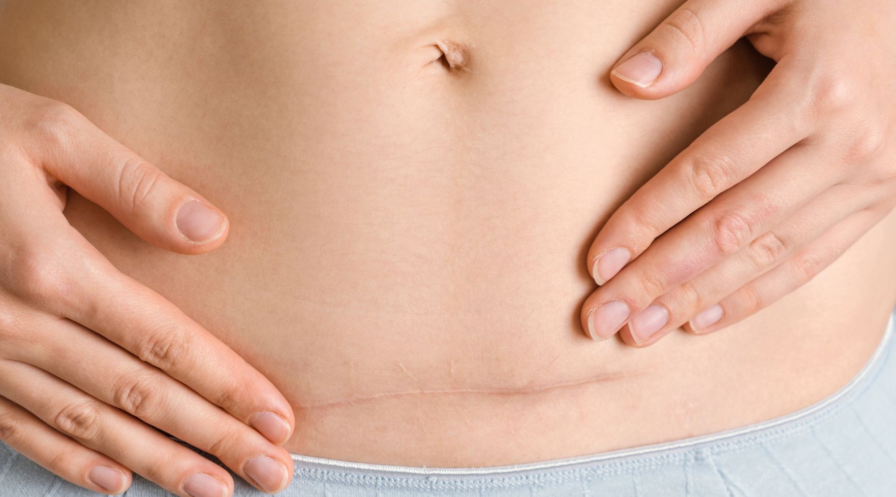 Jak przebiega gojenie po zabiegu chirurgicznym